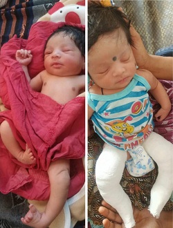 चिरायु ने लौटाया वंशिका के माता पिता की मुस्कान