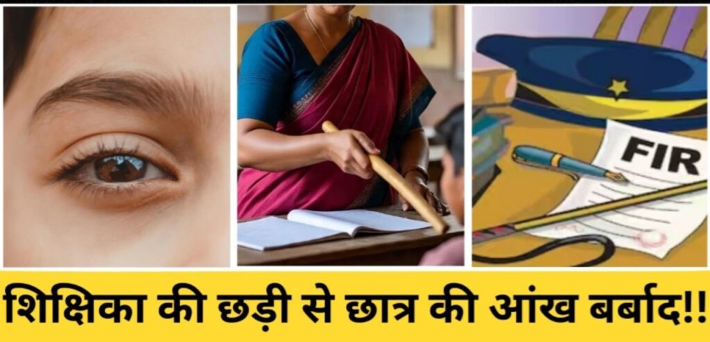 पिटाई के दौरान छात्र की आंख में घुसा दी छड़ी! चली गई मासूम की आंख की रोशनी